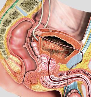 лечение мочеполовой системы у мужчин