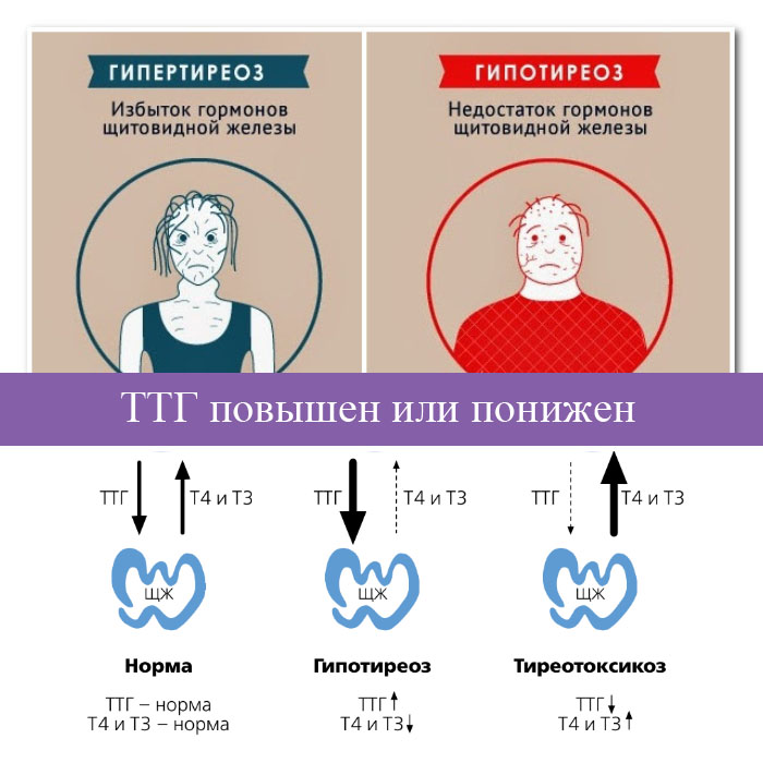 норма гормонов щитовидной железы в менопаузе