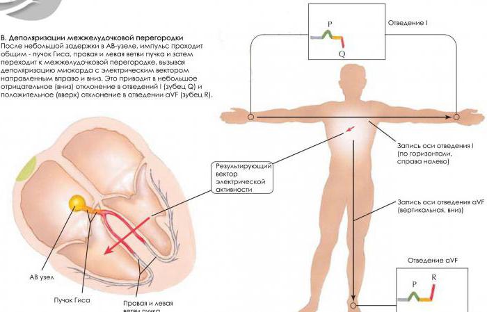 критический уровень деполяризации это уровень деполяризации