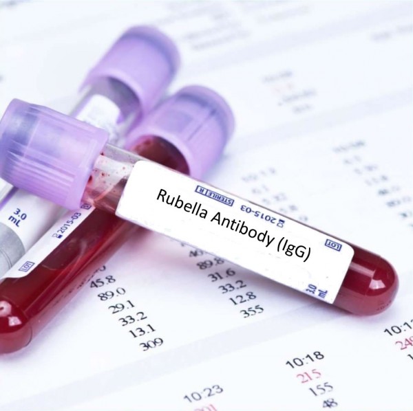 Анализ на антитела к Rubella