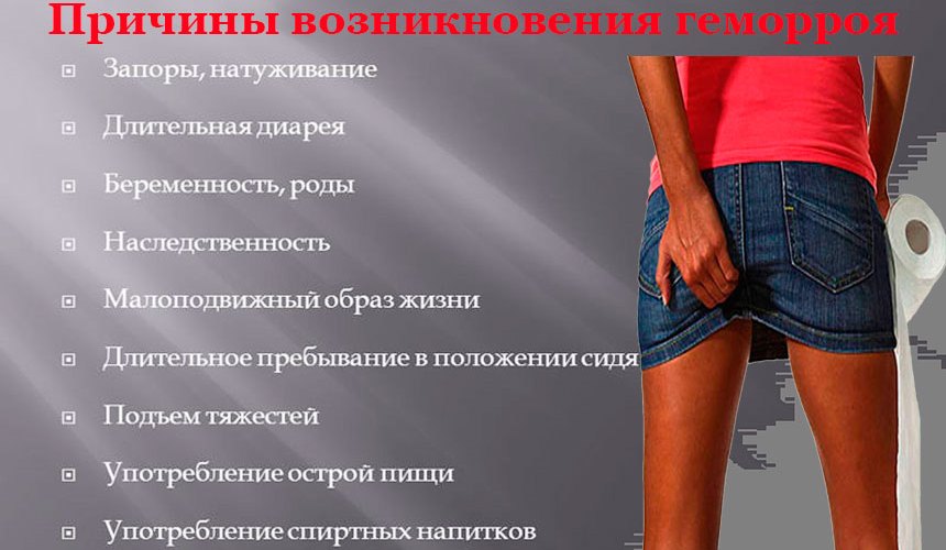 Геморрой 4 стадии причины, лечение с операцией и без