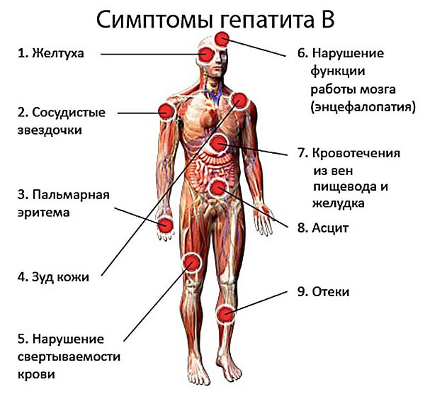 Симптомы гепатита В