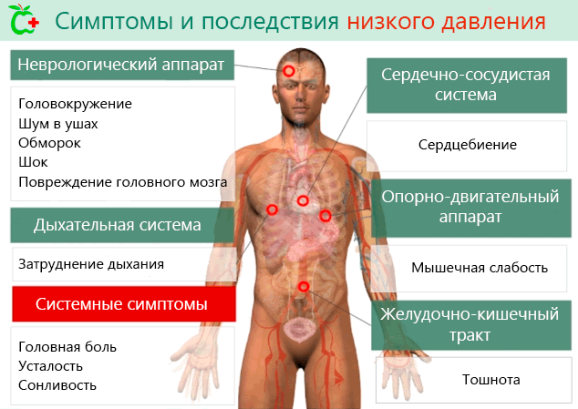 Симптомы гипотонии