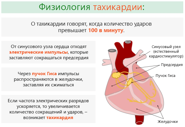 Что такое тахикардия