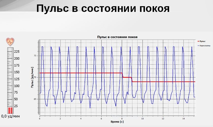 График пульса в состоянии покоя