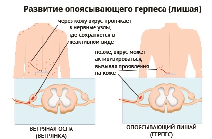 Сухие пятна на коже: шершавые, красные, белые, темные. Фото, причины и лечение у взрослых и детей