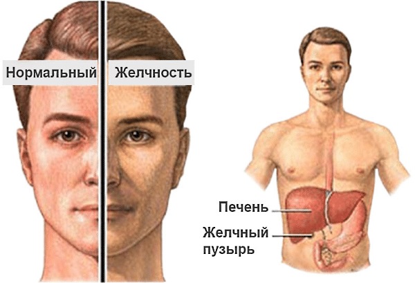 Желчный пузырь. Симптомы заболеваний, диагностика и лечение. Препараты, народные средства, диета