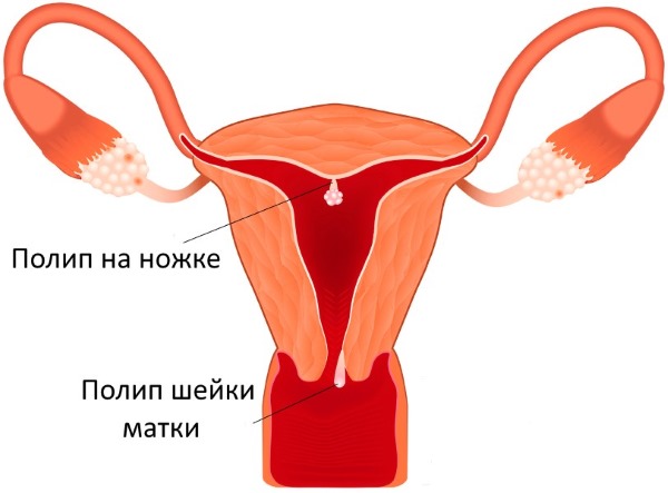 Размеры матки в норме у женщин по УЗИ. Таблица по возрасту, нерожавших, при беременности, после родов, при менопаузе