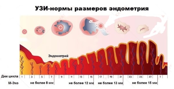 Размеры матки в норме у женщин по УЗИ. Таблица по возрасту, нерожавших, при беременности, после родов, при менопаузе