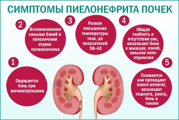 Пиелонефрит у ребенка. Симптомы, лечение. Антибиотики, народные средства