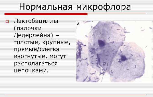 Эпителий в мазке у женщин . Норма в таблице по возрасту, при беременности. Расшифровка анализа