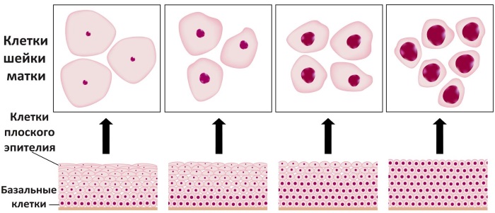 Эпителий в мазке у женщин . Норма в таблице по возрасту, при беременности. Расшифровка анализа