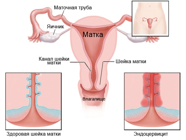 Эпителий в мазке у женщин . Норма в таблице по возрасту, при беременности. Расшифровка анализа