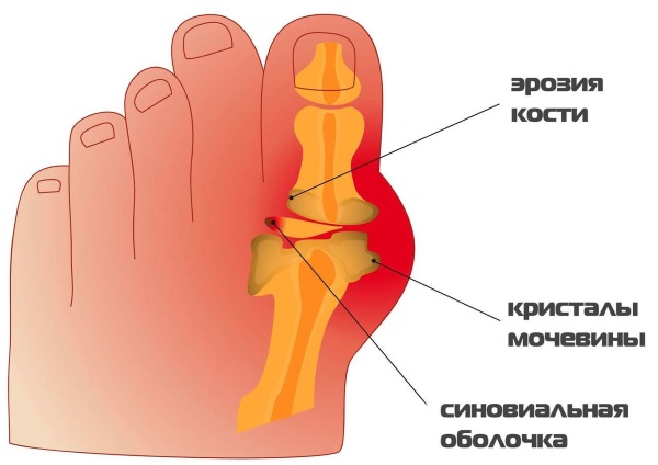 Корни шиповника. Лечебные свойства и противопоказания, вред, рецепты