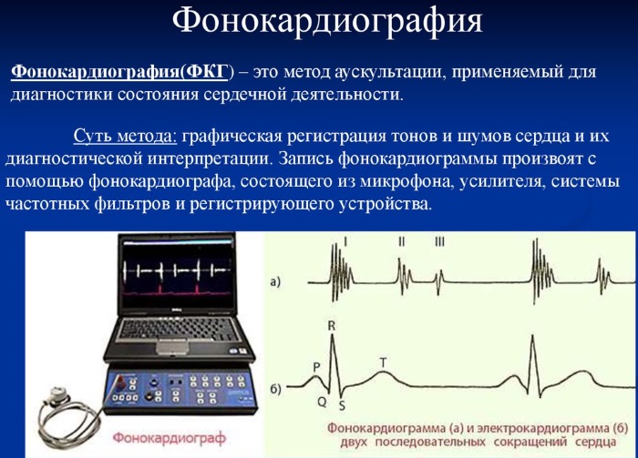 Расшифровка ЭКГ у взрослых. Норма: синусовый ритм, параметры, патологии