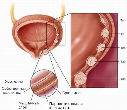 Мочевой пузырь. Болезни, симптомы, строение, признаки заболеваний, лечение