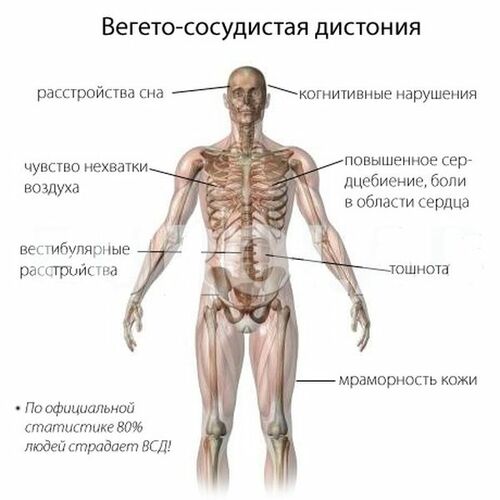 Вегето-сосудистая дистония. Симптомы, лечение, обострение у взрослых