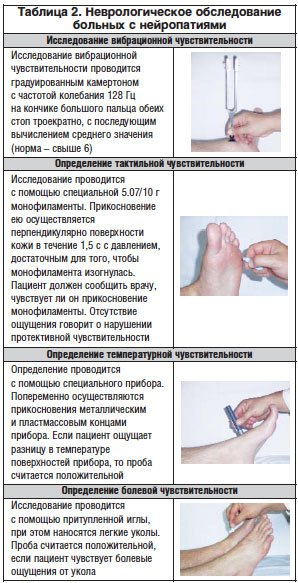 Диабетическая стопа. Что это, уход за ногами при диабете, лечение, классификация, рентген