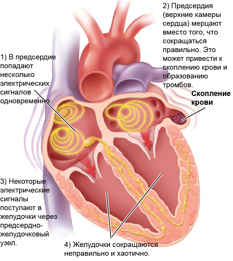 Сердце человека предсердие. Предсердия и желудочки. Предсердия сердца. Левое предсердие сердца. Правое предсердие сердца.