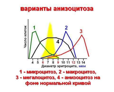 кривая Прайс-Джонса у больного