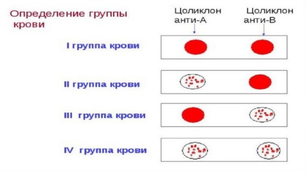 определение группы крови цоликлонами