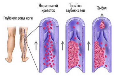 классификация АФС