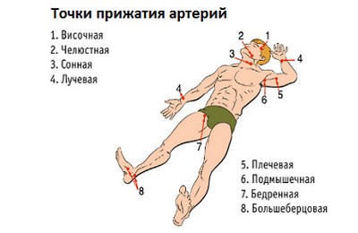 правила остановки кровотечения