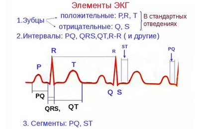 синусовая экстрасистолия