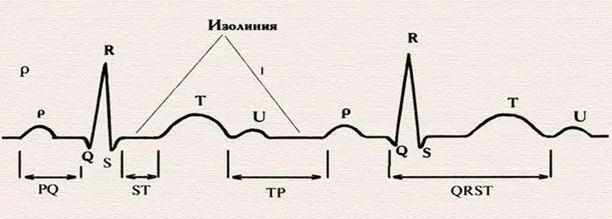 суточное мониторирование ЭКГ