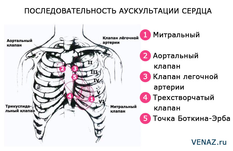 Аускультация сердца картинки