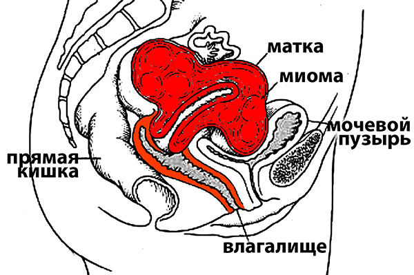 Матка мочевой. Мочевой пузырь и матка расположение. Матка давит на мочевой пузырь. Расположение матки и прямой кишки.