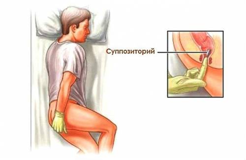 Применение ректальных свечей