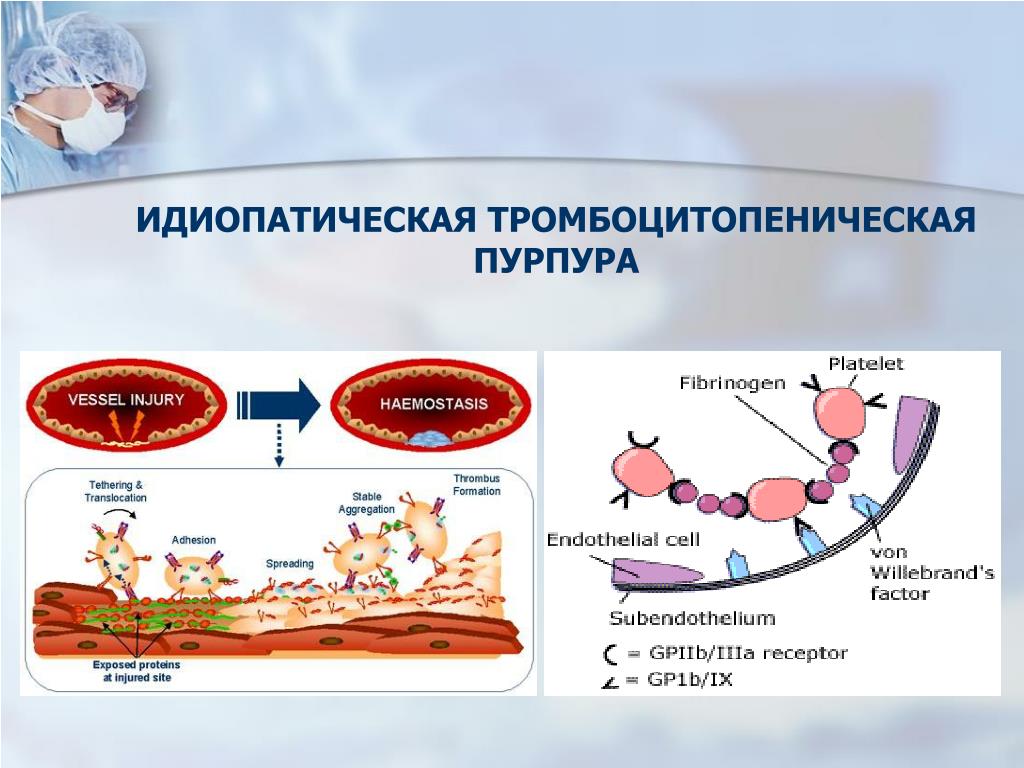 У больного тромбоцитопенией. Тромбоцитопеническая пурпура патогенез кровоточивости. Болезнь Верльгофа этиология. Идиопатическая (иммунная) тромбоцитопеническая пурпура. Механизм развития болезни Верльгофа..