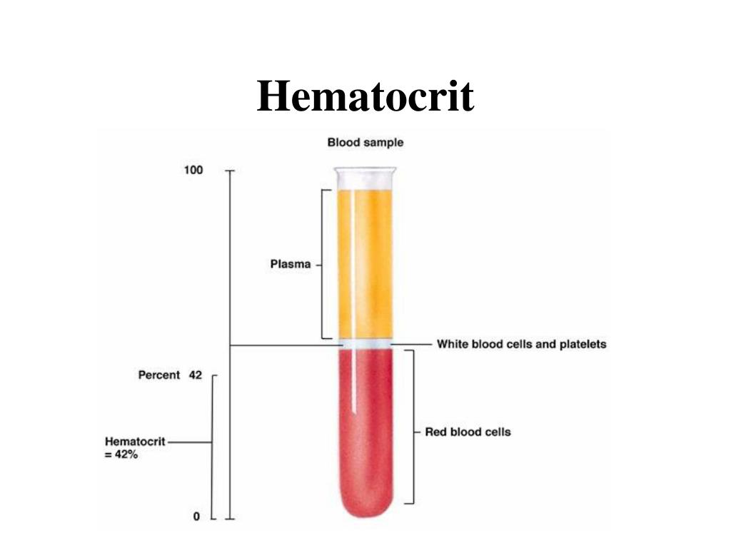 Фильтрующая плазма крови. Нормальные показатели гематокрита. Соотношение плазмы и форменных элементов крови (гематокрит). Гематокрит при анемии показатели. Как определить гематокритную величину крови.