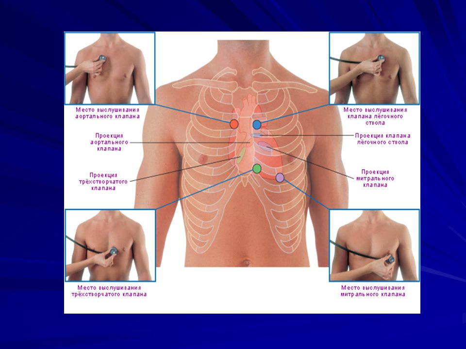 Проекция на грудную стенку. Аускультация сердца пропедевтика. Точки аускультации сердца пропедевтика. Верхушка сердца аускультация. Точки выслушивания клапанов сердца.