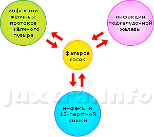 Схема 3. Фатеров сосок: место встечи изменить нельзя. Сюда сходятся и отсюда расходятся инфекции тесно взаимосвязанных органов: жёлчного пузыря с протоками, поджелудочной железы и двенадцатиперсной кишки. Поэтому не бывает хронического холецистита без панкреатита и панкреатита без холецистита