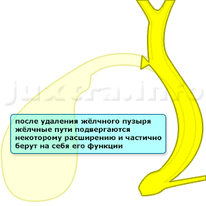 жёлчные пути после удаления жёлчного пузыря