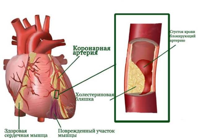 Схема 2