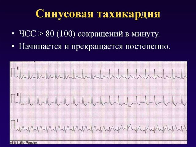 Инфографика 2