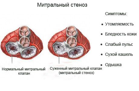 Инфографика