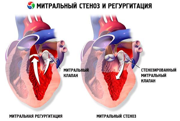 Инфографика 2