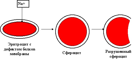 Наряду с нормальными эритроцитами при болезни Миньковского-Шофара имеются сфероциты