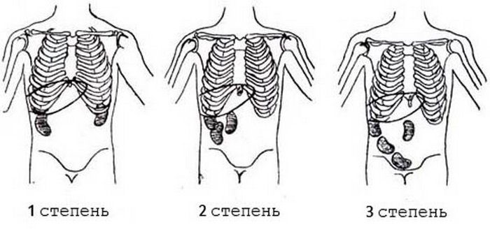 ротация почек