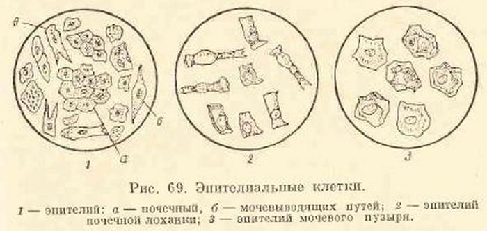 почечный эпителий в моче у ребенка