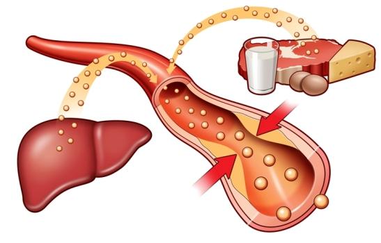 От чего образуется холестерин в крови