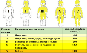 Степень развития желтухи