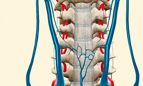 Асимметрия позвоночных артерий