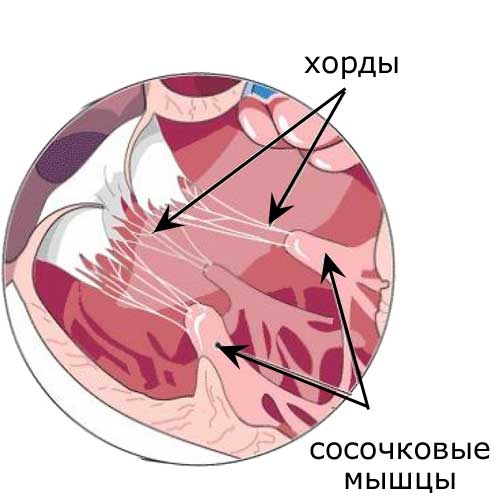 Хорда левого желудочка