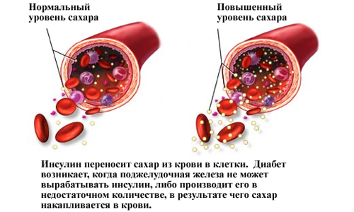 Показатели уровня сахара в крови