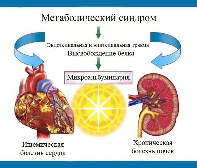 Микроальбуминария